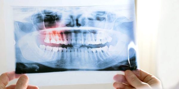 Radiologia odontoiatrica: Ortopantomografia, Telecranio, Dentalscan, TC Orecchio, TC Massiccio facciale Radiologia odontoiatrica: Ortopantomografia, Telecranio, Dentalscan, TC Orecchio, TC Massiccio facciale