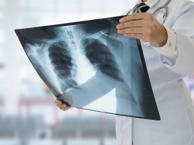 Radiologia Tradizionale Computerizzata di Tutti i Distretti Corporei
